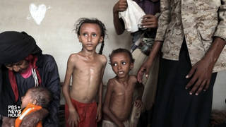 SEG2-YEMEN-CHILDREN-FAMINE.jpg